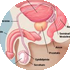 Prostate gland enlargement listing