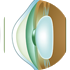 Ashthmatic eye